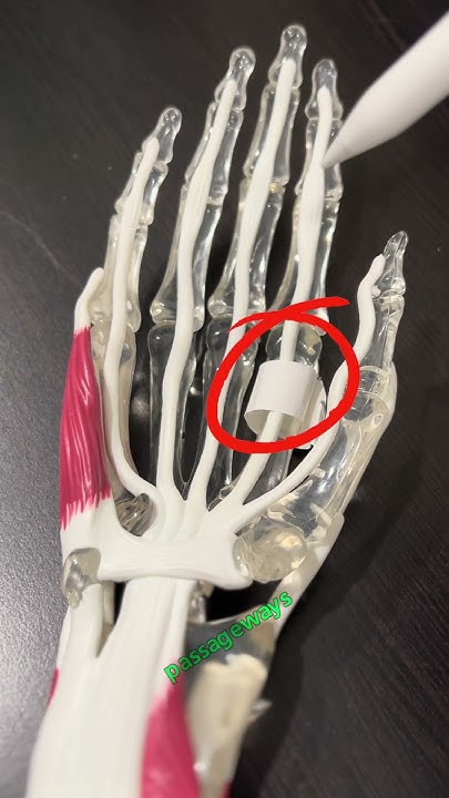 ThatHandDoc's tweet card. HAND DOC - Why is my finger triggering?! #triggerfinger #surgeonlife...