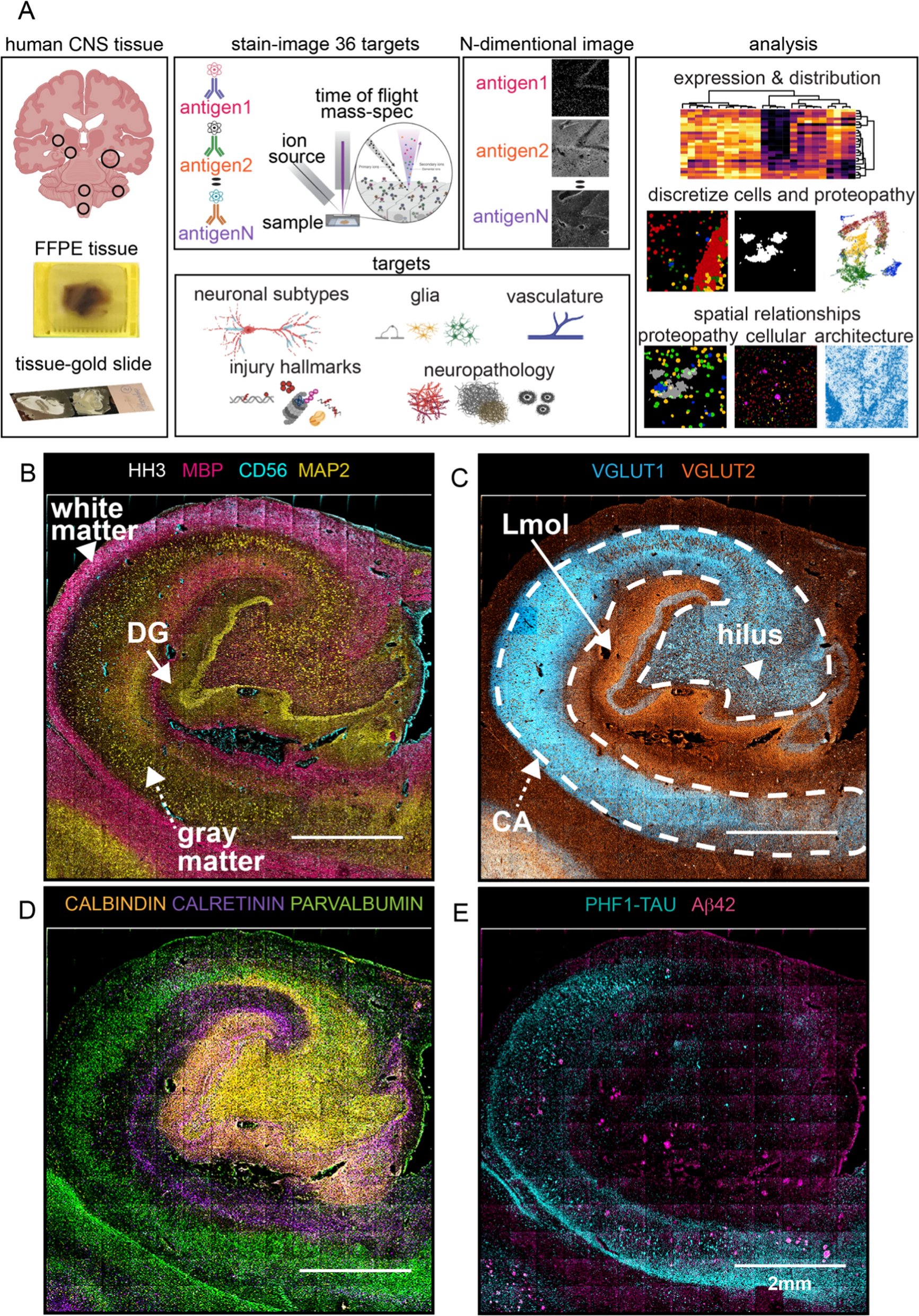 BryJCannon's tweet card. Acta Neuropathologica Communications - Neurodegenerative disorders are characterized by phenotypic changes and hallmark proteopathies. Quantifying these in archival human brain tissues remains...
