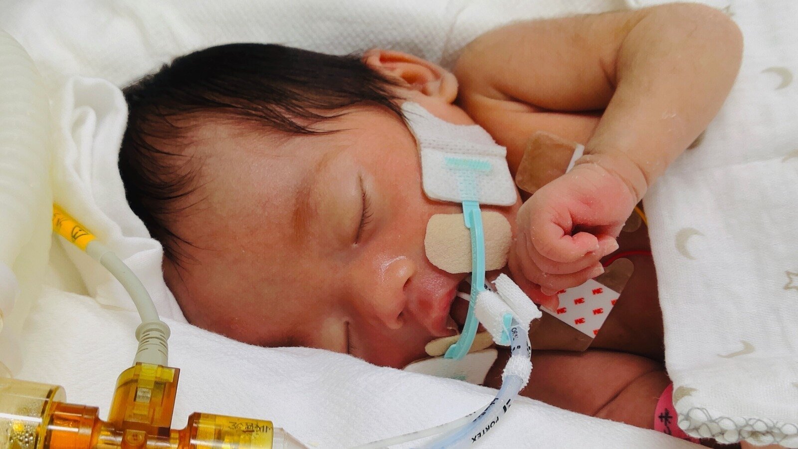 llbe_programing's tweet card. 妊婦の死亡事故　緊急帝王切開で産まれ、重度の障害を負いながら懸命に生きる娘は被害者ではないのか？「胎児への加害行為に対して過失運転致傷での起訴を求めます」（起訴後は厳罰を求めます）