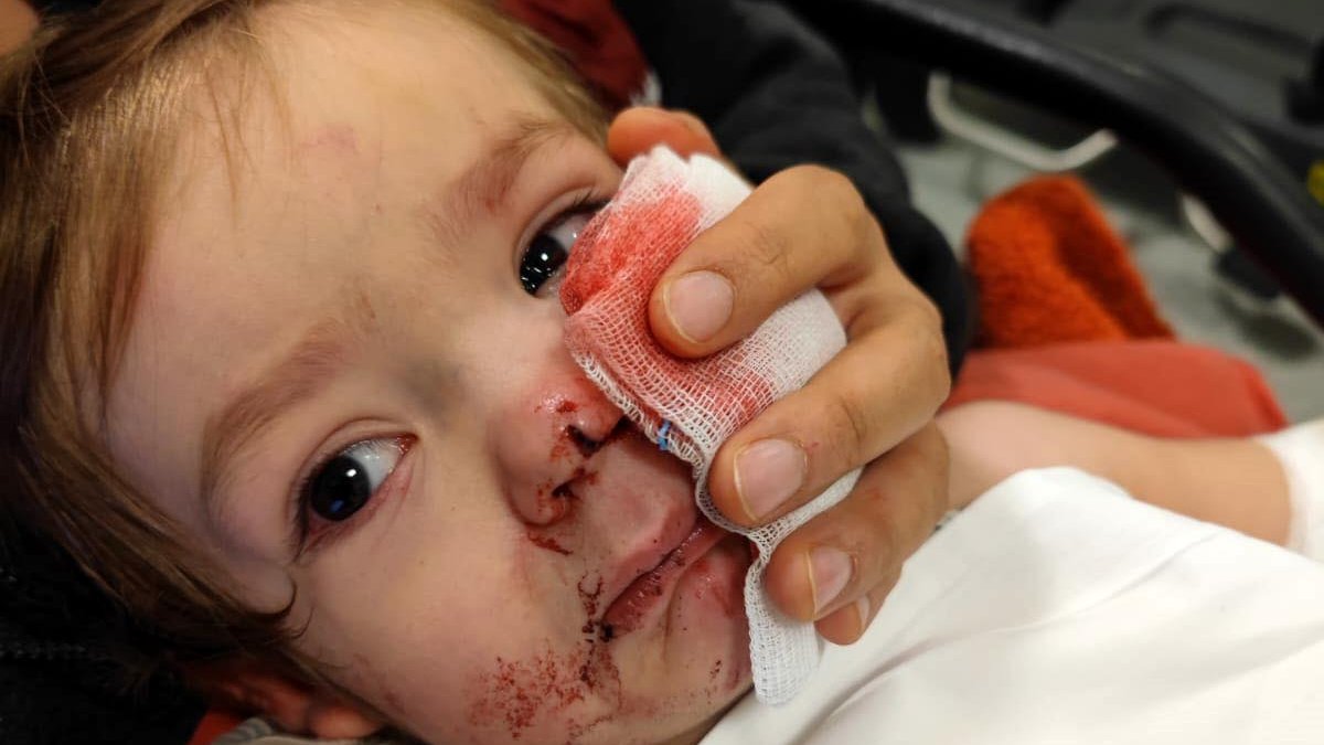 hikmetgenc's tweet card. Ankara'da 1,5 yaşındaki Efe ve 5 yaşındaki Doğa Öztürk kardeşlere saldıran pitbull ve sahibi Tuğçe Ö.E., yakalandı. Köpek belediye ekipleri tarafından barınağa götürülürken sahibi ise tutuklanarak...