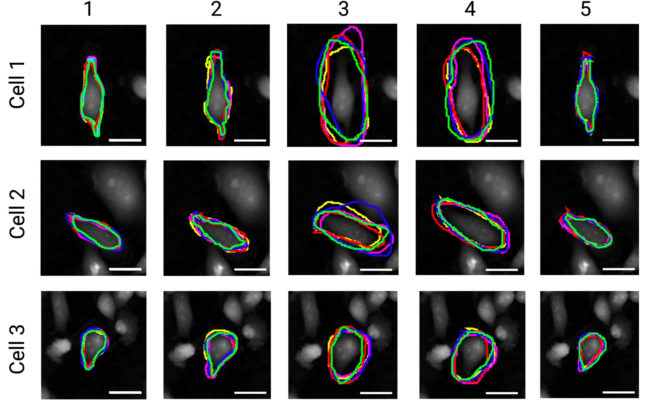 YorkBioimaging's tweet card. While manual segmentation and tracking of cells from microscopy images remain common practices in biological studies, our work demonstrates the inter- and intra-user variability that can arise from...