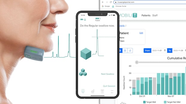CSNPcollision's tweet card. A health tech company has developed a product for anyone struggling with swallowing, and for David Jamieson it has been transformative. 
