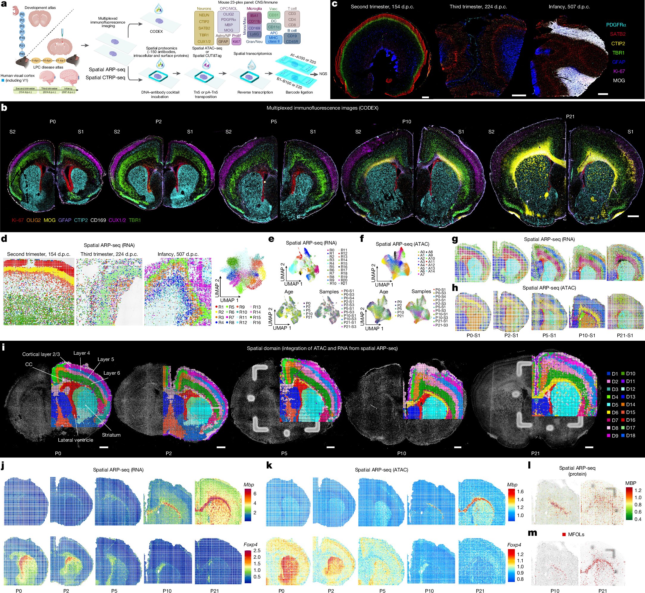 RongFan8's tweet card. Nature - A tri-omic atlas of the mouse brain from postnatal day 0 to P21 reveals that layer-specific projection neurons have a role in coordinating axonogenesis and myelination.