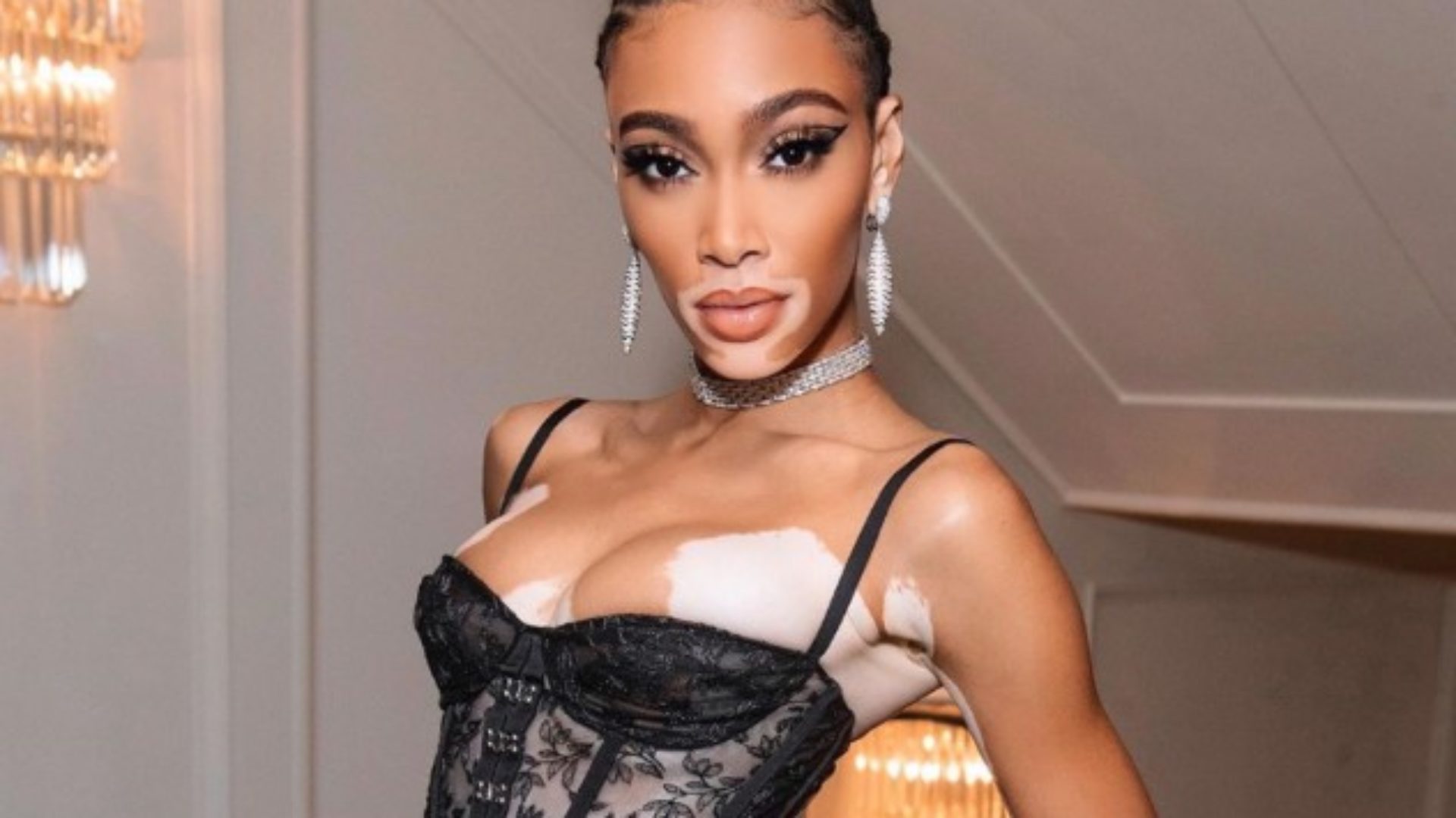 Essence's tweet card. Model and spokesperson Winnie Harlow talks about how her vitiligo has changed over the past six years and how she embraces it.