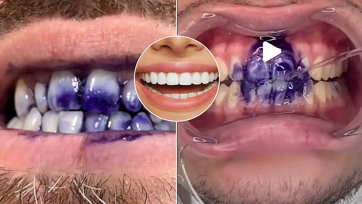 RomaTVsk's tweet card. Biely úsmev je pre mnohých symbolom zdravia, úspechu a atraktívneho vzhľadu. Prieskum zubnej kliniky Dr. Martin však odhalil, že až tretina Slovákov netuší, že