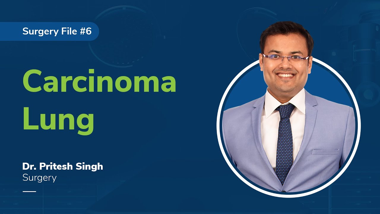 drpriteshsingh's tweet card. Dr. Pritesh Singh Discusses the topic "Carcinoma Lung" - Surgery