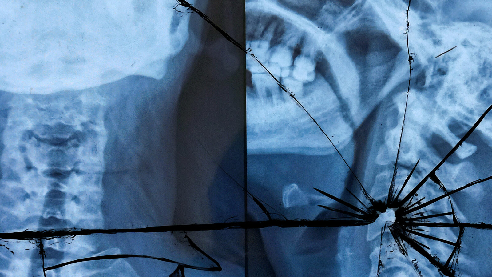 jimfornyc's tweet card. Compared to human drivers, Waymo cars were involved in 91 percent fewer crashes that resulted in serious injuries.