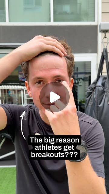 RockwellFound's tweet card. Helmet Head Anti-Acne Sport Patches (@helmetheadpatch) • Instagram reel