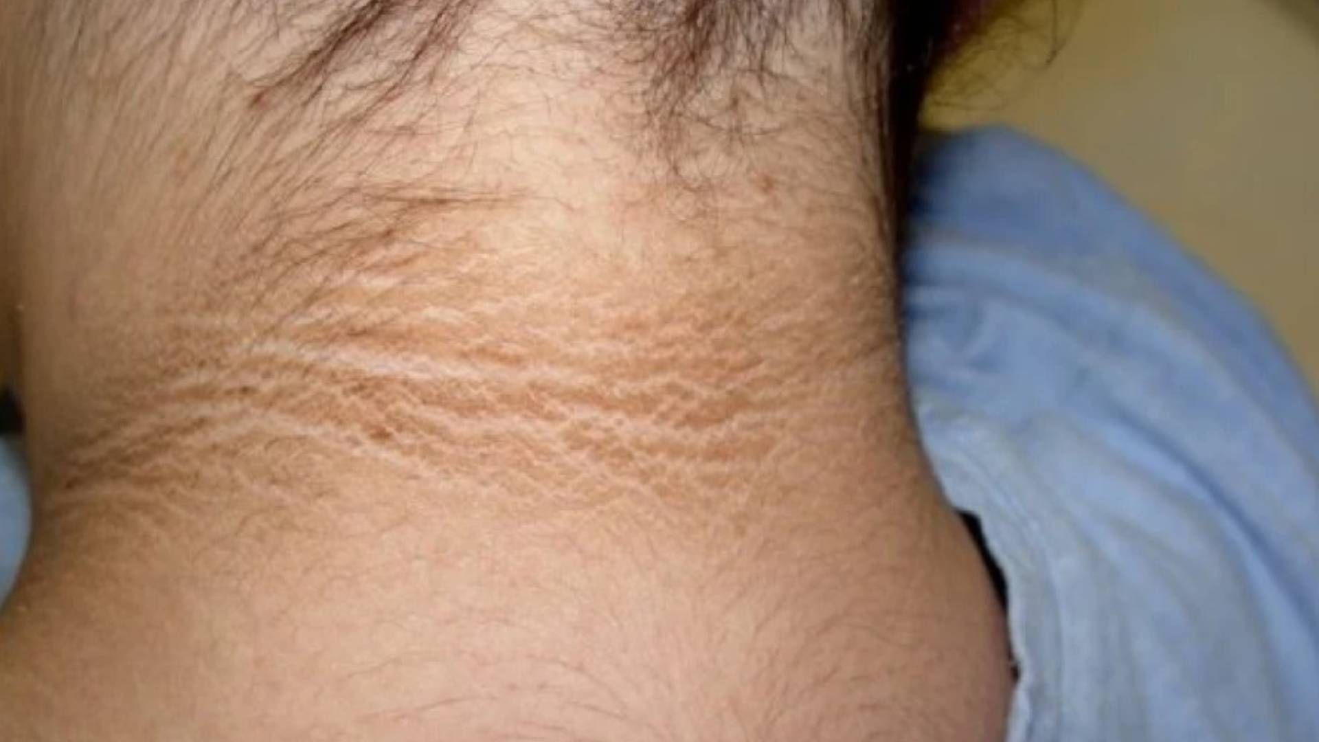 AztecaYucatan's tweet card. La prediabetes se podría ser tu mejor aliada si logras detectarla antes de su desarrollo, para lograrlo, te contamos qué es, los síntomas y cómo prevenirla.