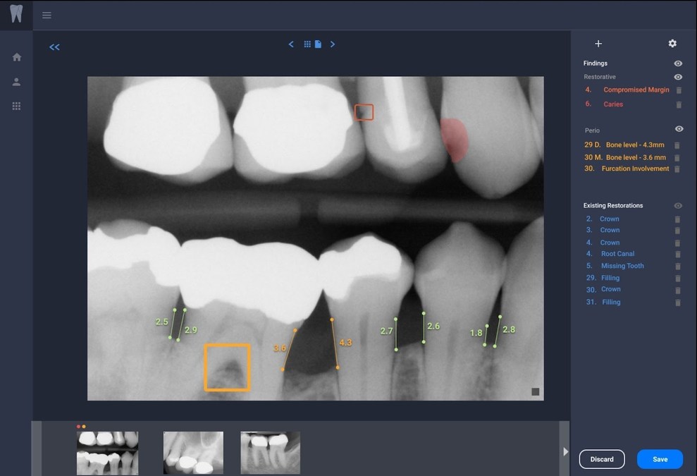 cipherbio_gibbs's tweet card. /PRNewswire/ -- Amid accelerated demand for its dental artificial intelligence (AI) software, Overjet (www.overjet.ai) today announced it has raised $42.5...