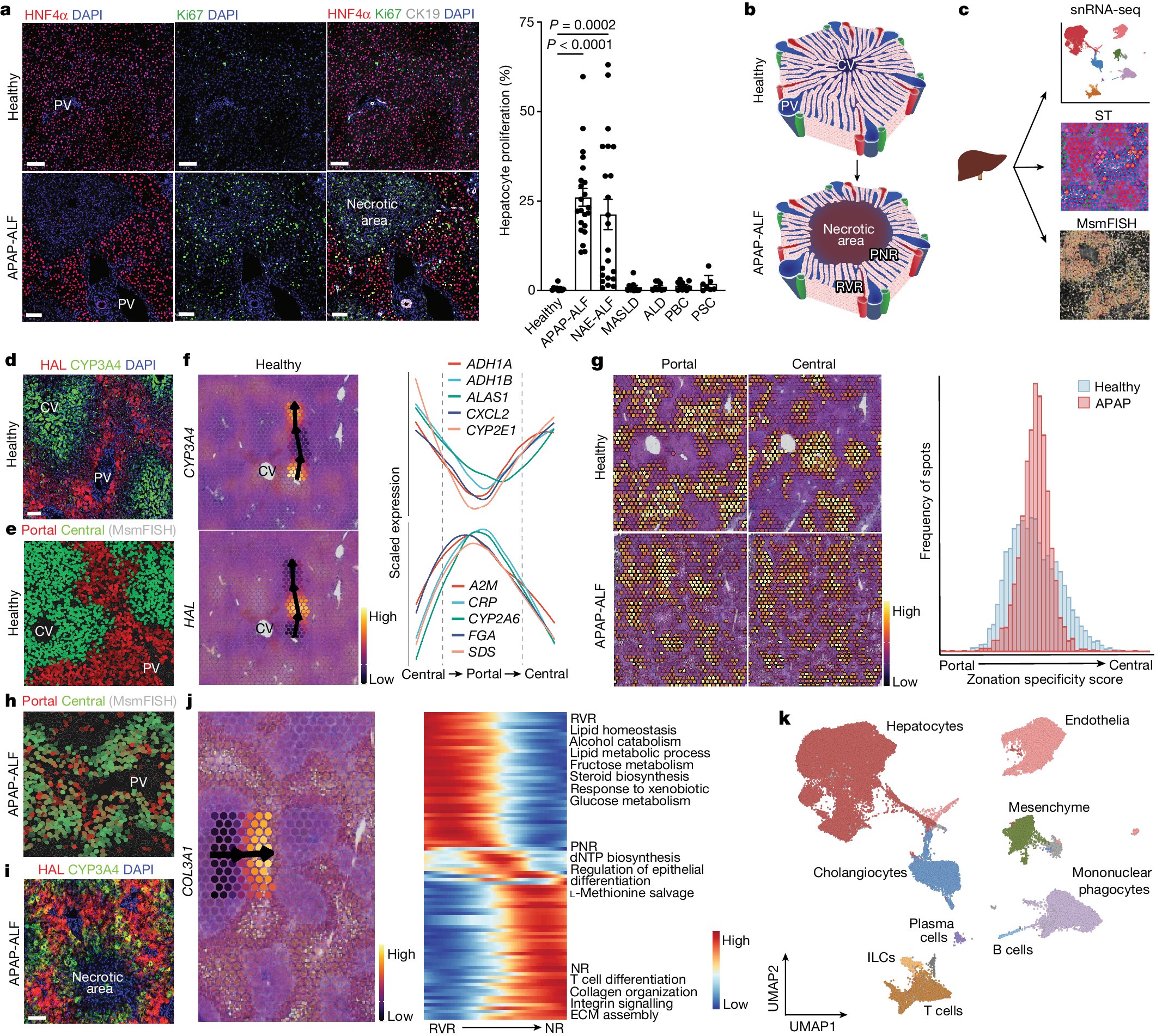 Nature's tweet card. Nature - Harnessing single-nucleus RNA sequencing and spatial profiling, this work dissects unanticipated aspects of human liver regeneration to uncover a novel migratory hepatocyte subpopulation...