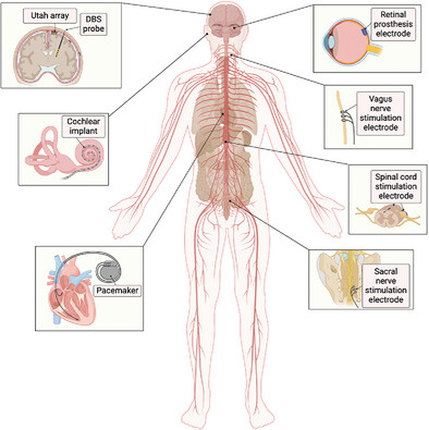 GeorgeMalliaras's tweet card. This review explores the integration of responsive materials and soft robotic actuators with implantable electronics to address key challenges in bioelectronic medicine. By enabling shape actuation,...