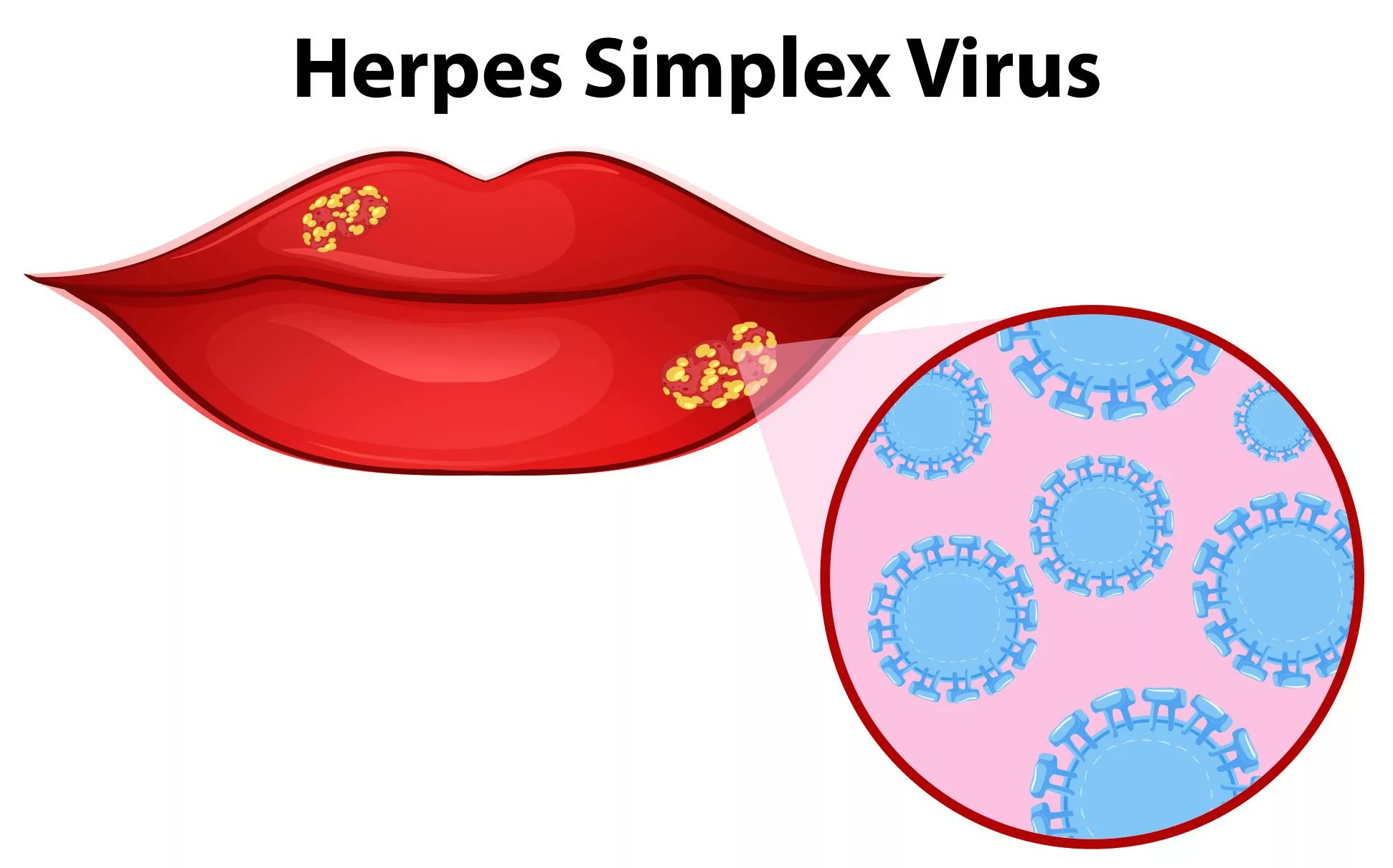 TechExplorist's tweet card. The herpes virus blueprint was revealed after 40 years.