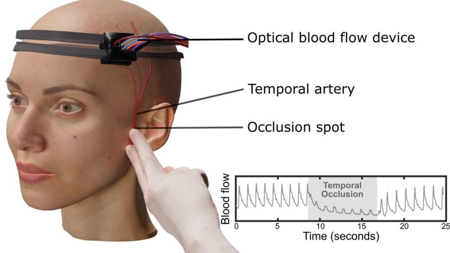 PointClearHIT's tweet card. WASHINGTON, Oct. 21, 2025 — Measuring how well blood flows to the brain is crucial for understanding a wide range of neurological issues, from strokes to migraines […]