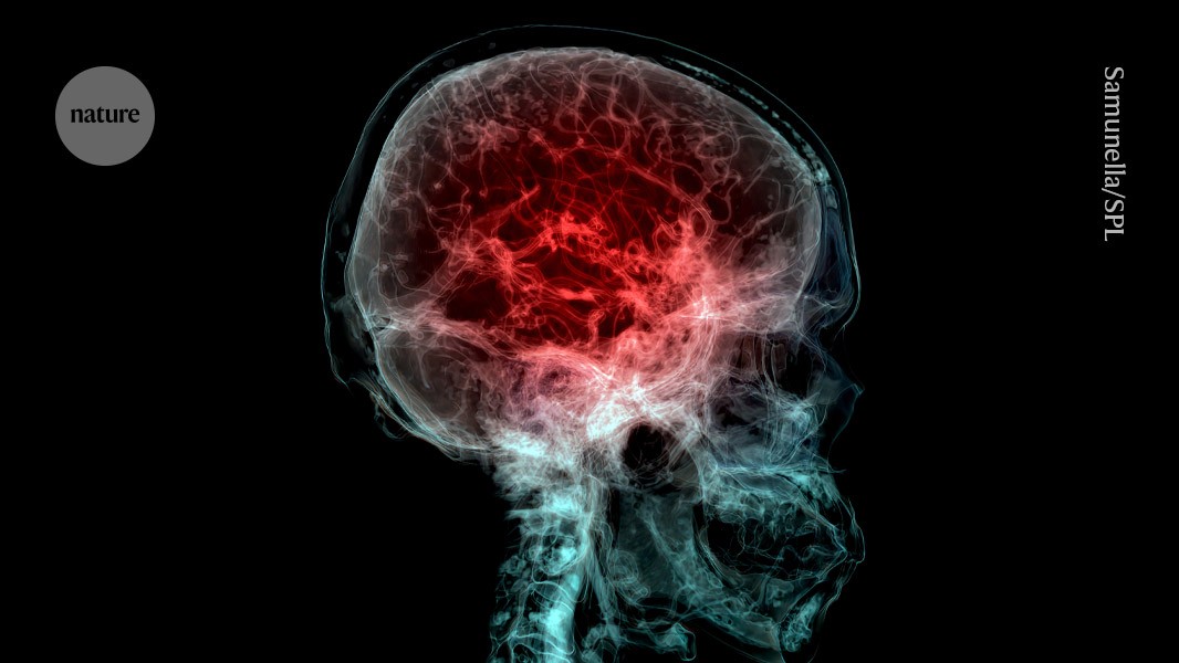 cd2023c's tweet card. Nature - The large prefrontal cortex provides evolutionary and cognitive advantages over non-human primates — but there’s a cost.