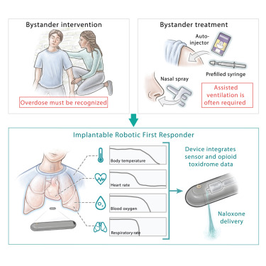 CellPressNews's tweet card. The implantable SOS (iSOS) consists of a suite of sensors that measure vital signs combined with a drug reservoir that stores naloxone. When the iSOS detects a combination of vital signs indicating...