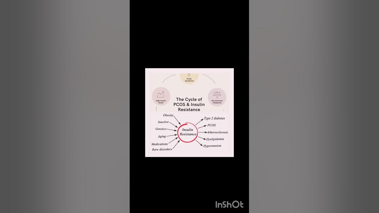 IqraHussainSyed's tweet card. PCOS and Insulin resistance