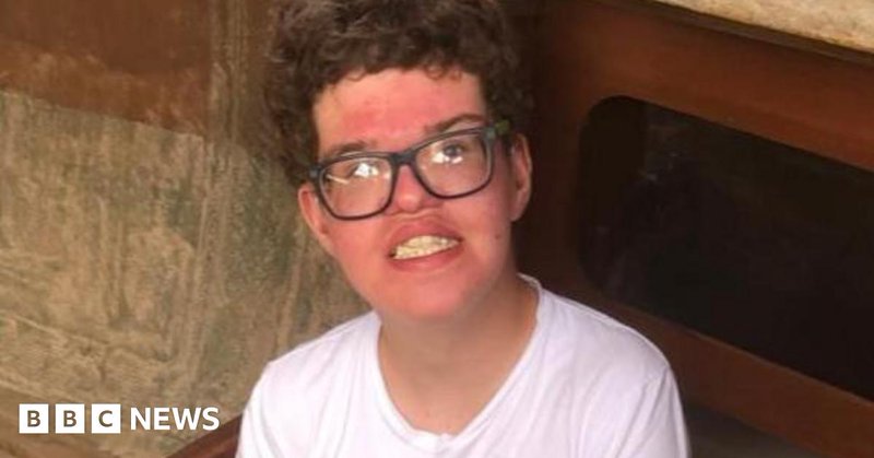 Tweet card summary image