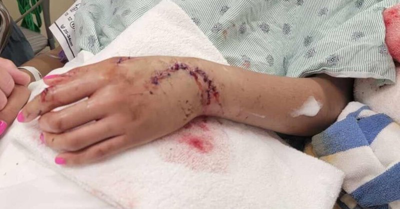 Tweet card summary image