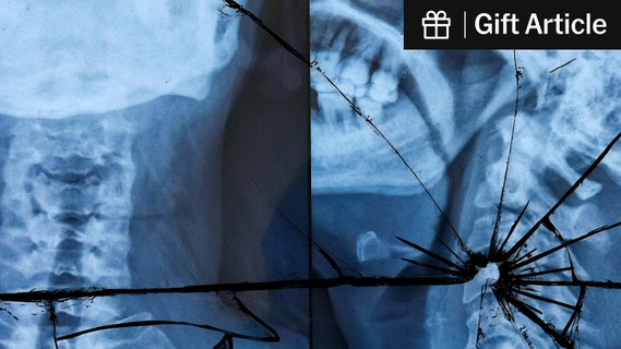 Image for twitter card