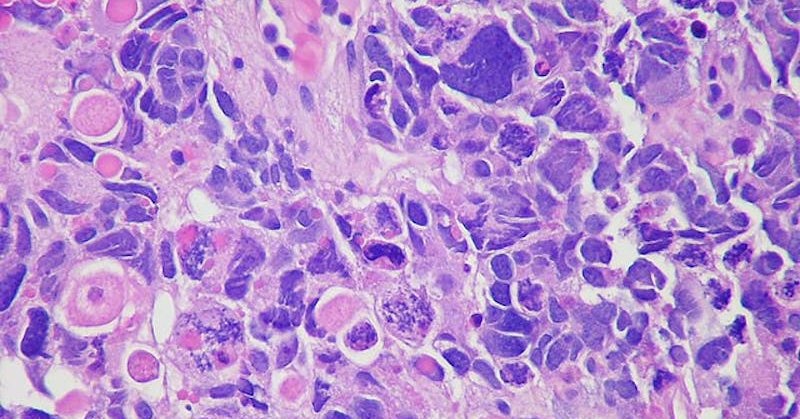 Tweet card summary image