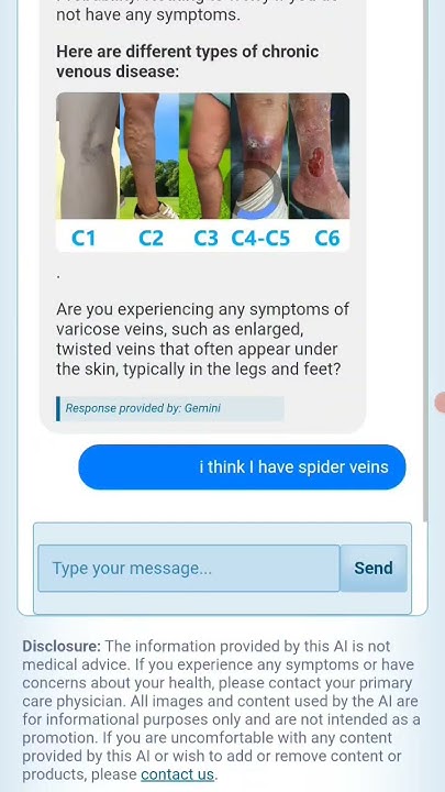 MLHealthScience's tweet card. Walkthrough: Varicose Veins Risk Prediction with AI | #WebAI App...