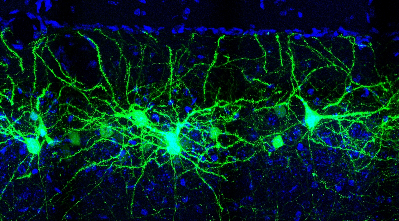 EdHuttlin's tweet card. In the last decade, research has highlighted the complement pathway's role in brain function, including synapse pruning and diseases. Our lab recently discovered a new intracellular pathway where...