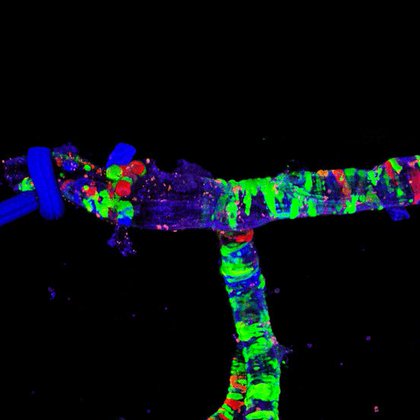 Tweet card summary image