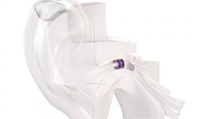 DocCRD's tweet card. Excessive noise, hearing loss, vascular constriction, old age – hearing difficulties can be caused by many factors. To help improve the quality of life of people with hearing impairment, Mannheim...