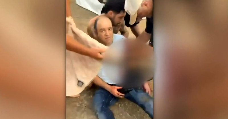 Tweet card summary image