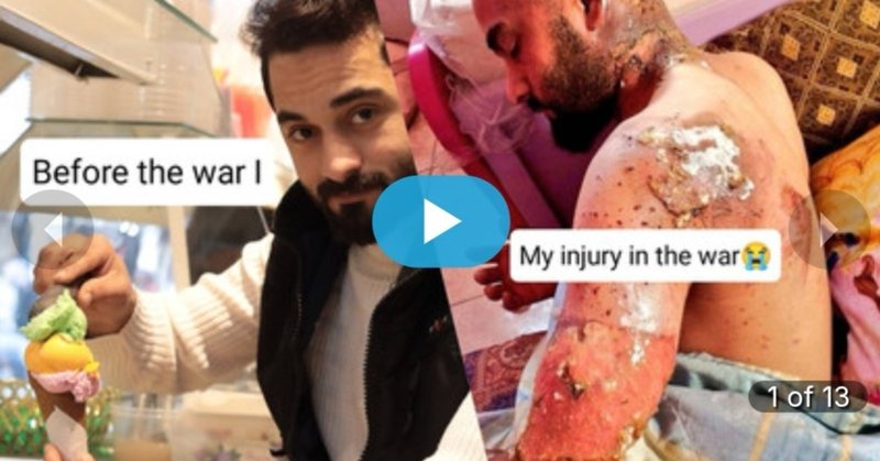 Tweet card summary image