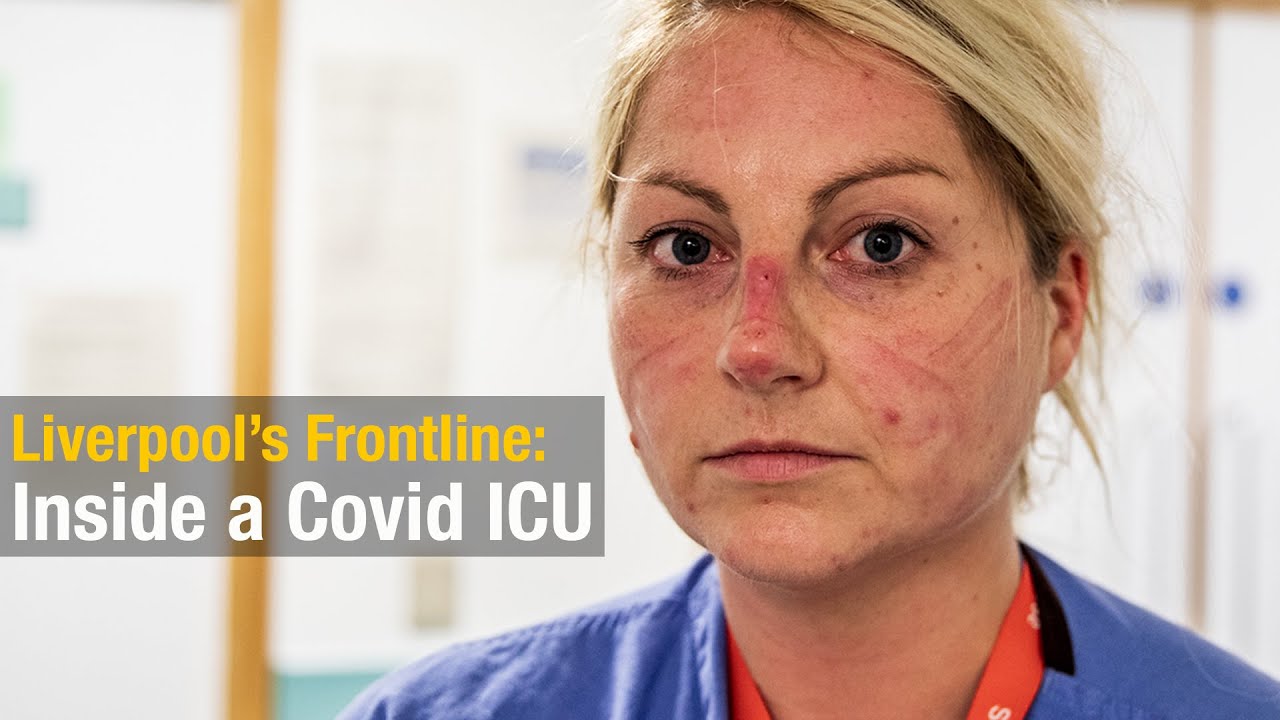 ProfCalumSemple's tweet card. Liverpool's Frontline: Inside a Covid ICU