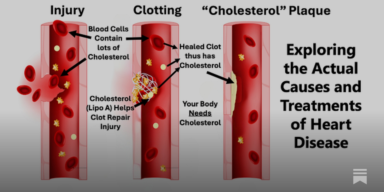 PierreKory's tweet card. Exploring the Actual Causes and Treatments of Heart Disease