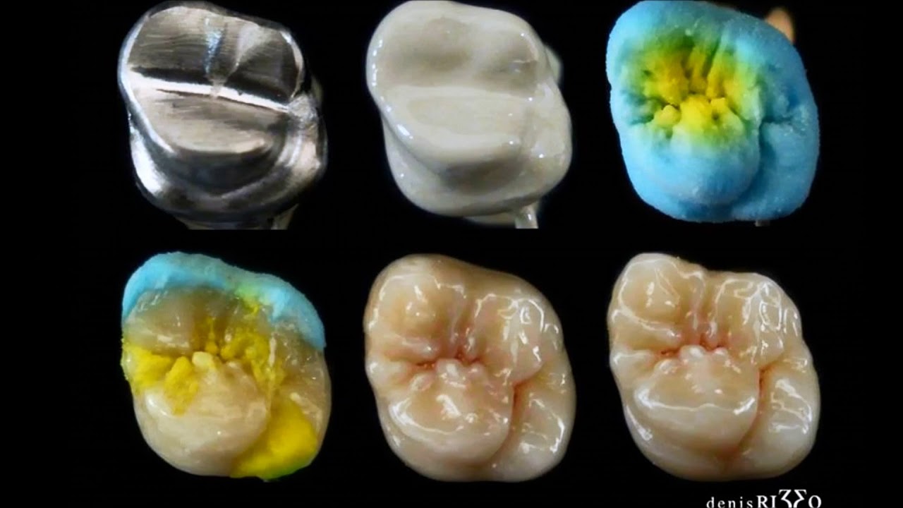 bigpythan's tweet card. Conférence Denis Rizzo à Pau le 09/11/2018...