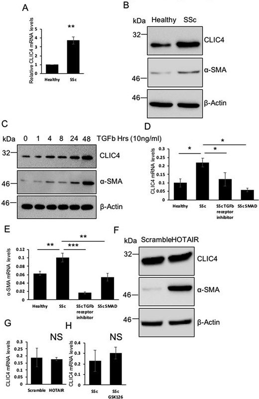 SclerodermaLab's tweet card. AbstractObjectives. Tissue fibrosis in SSc is driven by active fibroblasts (myofibroblasts). Previous studies have shown the intracellular chloride channel