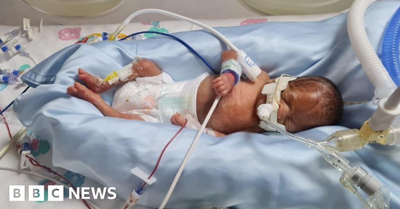 Tweet card summary image