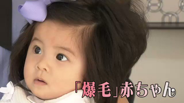 ふっさふさの髪の毛をもつ赤ちゃんに世界が夢中 Twitter ふっさふさの髪の毛をもつ赤ちゃんに世界が夢中 Twitter