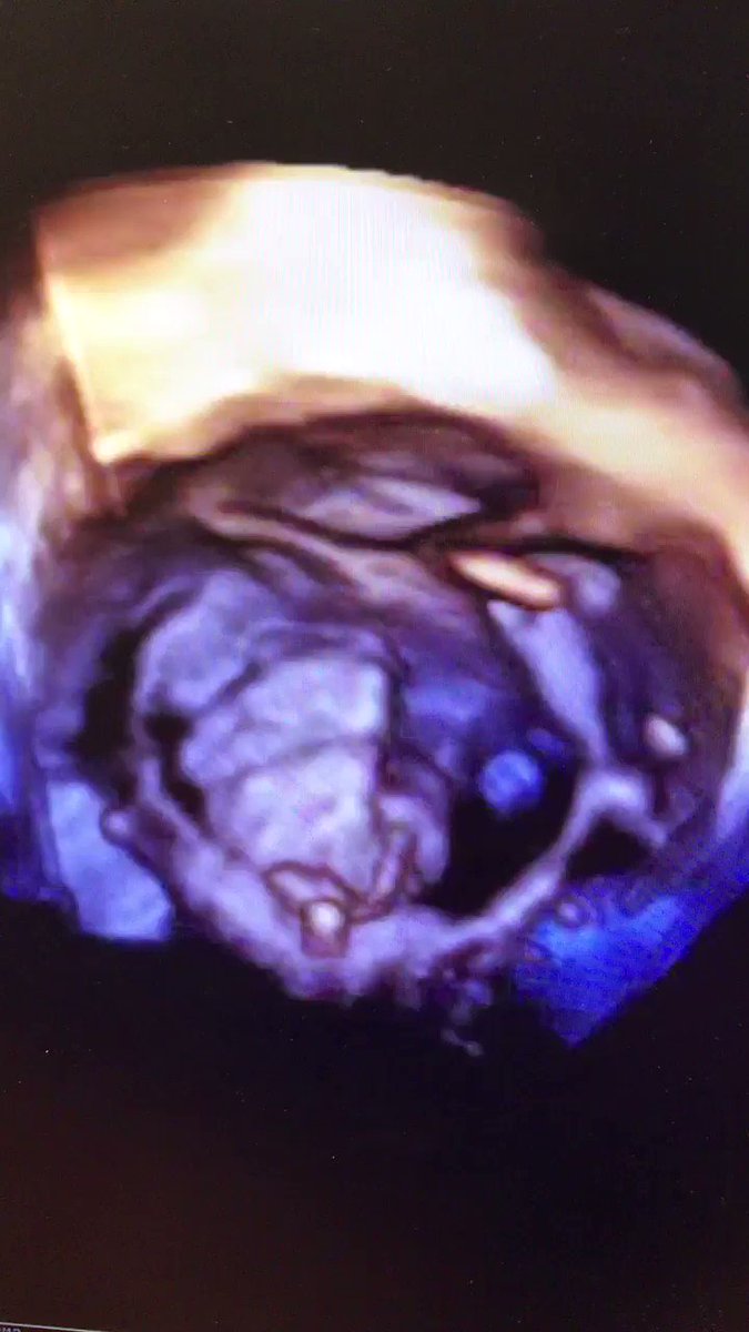 BrHeartValveSoc photo