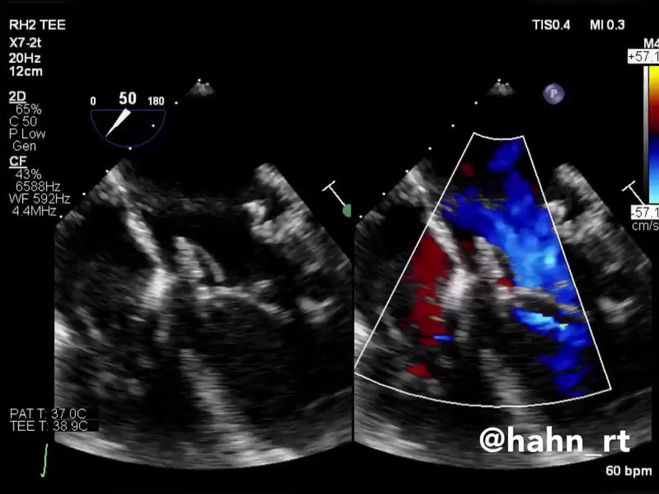 BrHeartValveSoc photo
