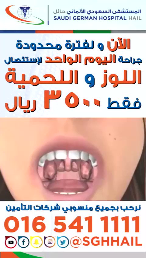 المستشفى السعودي الألماني حائل Twitter वर اللوز واللحمية جراحة اليوم الواحد ٣٥٠٠ريال للحجز والاستفسار 920007997