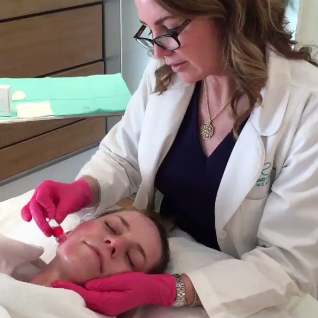 "Honestly, I don't feel nothing..." ✨😍
The results speak for themselves! AQUAGOLD® fine touch™ is revolutionizing skin treatment one patient at a time!
📹@dr.roche
*Medical grade device.
#aquagoldfinetouch #microchanneling #medicaldevice