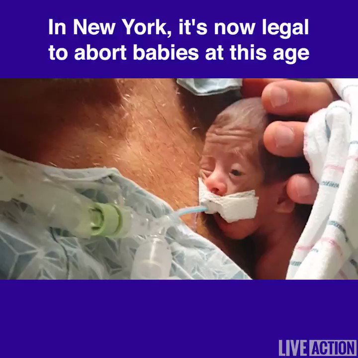 In New York, babies this age can now be aborted for practically any reason until birth.
RT if you believe this must change.