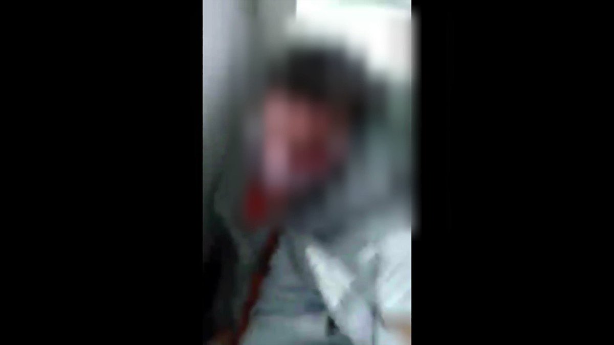 In the same city as Jussie's "attack," a mentally disabled teen was kidnapped, tied up for 5 hours, and scalped/beaten by 4 people on livestream
They screamed "fuck Donald Trump" and "fuck white people" as the beat him
Nowhere near the same amount of coverage as Jussie, though