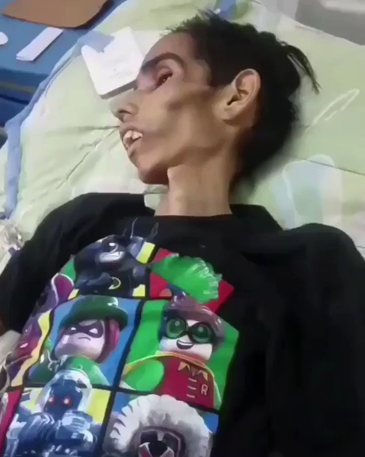 Hey Bernie, This is Venezuela Socialist healthcare. Is this what you want for America?