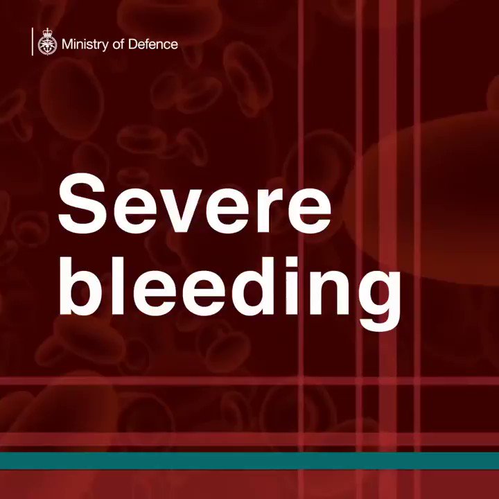 Watch this video about the new technology being developed by some of our Military Doctors and Scientists to stop rapid blood loss on the battlefield. #innovation #cuttingedge