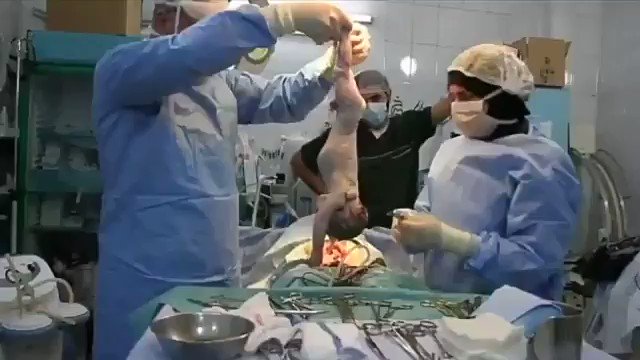 Doğum sırasında kalbi duran bebeğin, hayata döndürüldüğü muhteşem anlar... https://t.co/BetkvFacAE