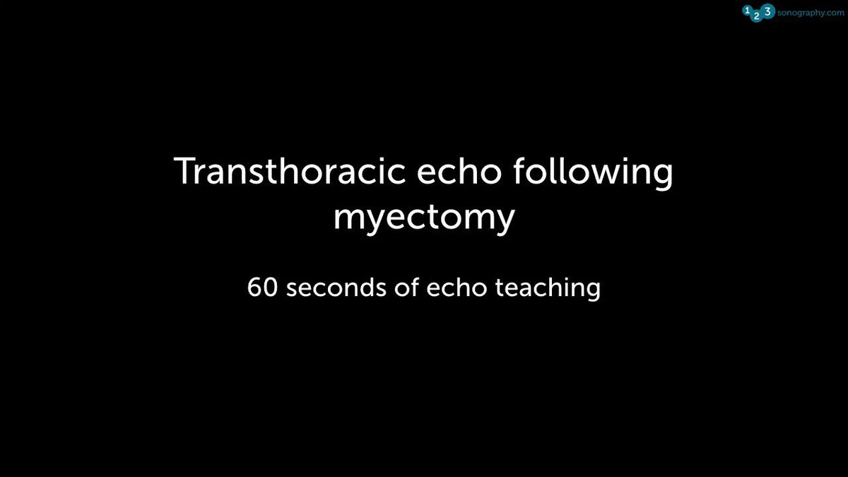 60 Seconds of Echo Teaching Answer: The patient had hypertrophic obstructive CMP and underwent surgical myectomy.
▶️ Sign up to one of our courses today: https://www.123sonography.com/echo-ultrasound
#Echocardiology #eLearning #MedicalUltrasound