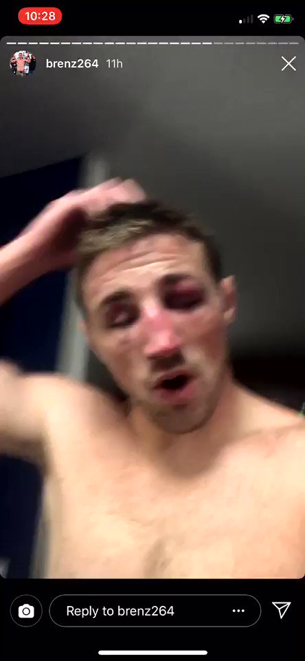 Brendan Loughnane was urinating blood after his win last night on Contender Series. (Video courtesy of his IG: https://instagram.com/brenz264?igshid=1pkmncq9q95nv …. H/t @mma_kings)