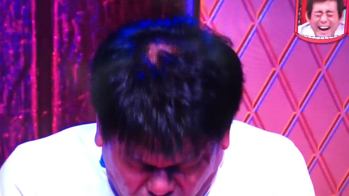 19年8月21日 水曜日のダウンタウンで ジミー大西 が話題に 水ダウ 5ページ目 トレンドアットtv 19年8月21日 水曜日のダウンタウンで ジミー大西 が話題に 水ダウ 5ページ目 トレンドアットtv