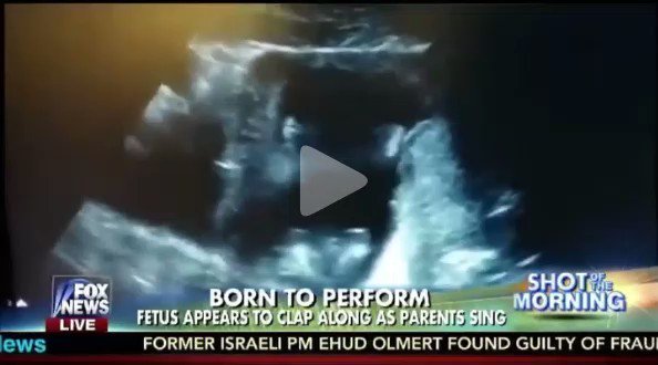 But you have no guilt when it comes to killing unborn babies 🤔RT: @frfrankpavone🚨**Viral**🚨 Watch this 14 week old unborn baby clapping her hands as her parents sing to her! #WednesdayMotivation #WednesdayThoughts #prolife #love